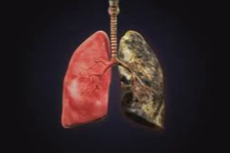 Akciğer Kanserinin Yüzde 90 Sebebi Sigara