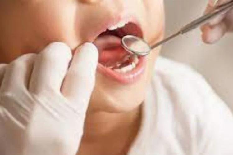 “Çürük Dişler Böbreğe Zarar Veren Bakteriler Üretirler”