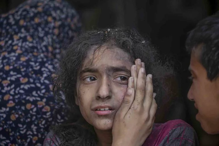 Gazze’de Can Kaybı 34 Bin 535’e Yükseldi